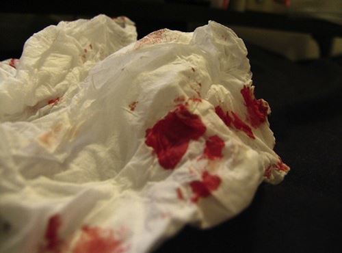 Nose bleed tissue
